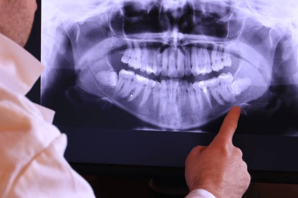 Best Emergency Dental Care for Broken or Chipped Teeth in Stanley, WI