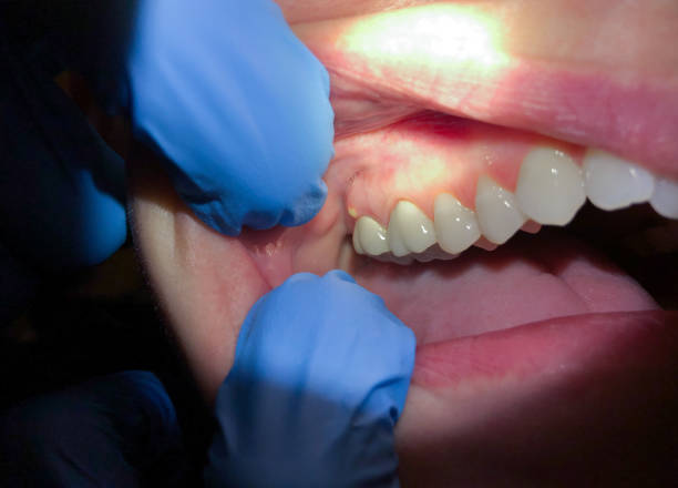 Best Pediatric Emergency Dentist in Stanley, WI
