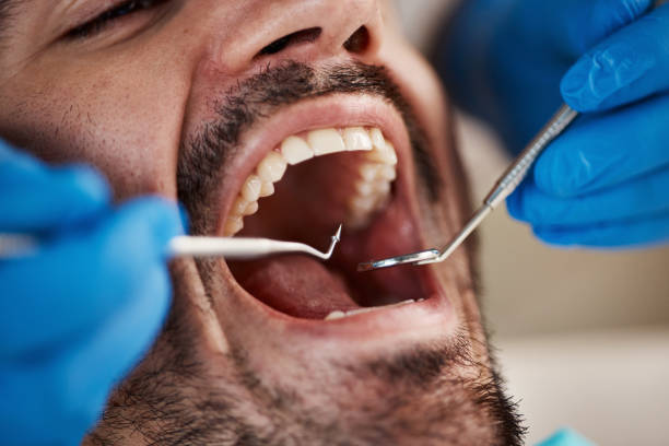 Best Urgent Care for Lost Fillings or Crowns in Stanley, WI